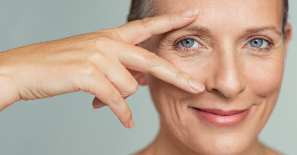 Woman showing improved skin texture and reduced under eye wrinkles