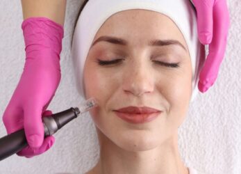 Woman with a white towel headband relaxing with her eyes closed while a provider in pink gloves performs a microneedling treatment on her face