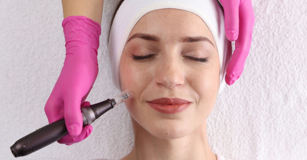 Woman with a white towel headband relaxing with her eyes closed while a provider in pink gloves performs a microneedling treatment on her face
