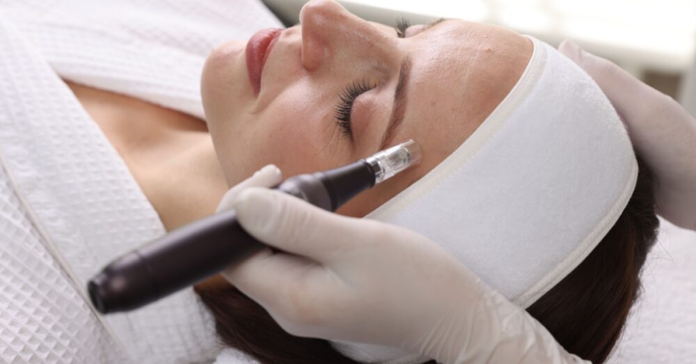 A provider applying a microneedling device to a woman's face