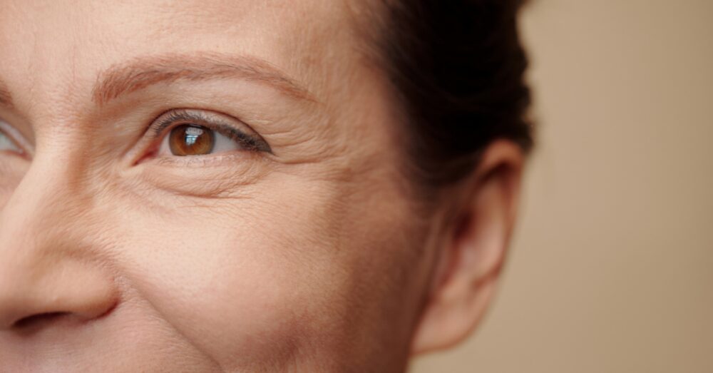 Close-up of a woman's face showing fine lines and wrinkles around the eye area