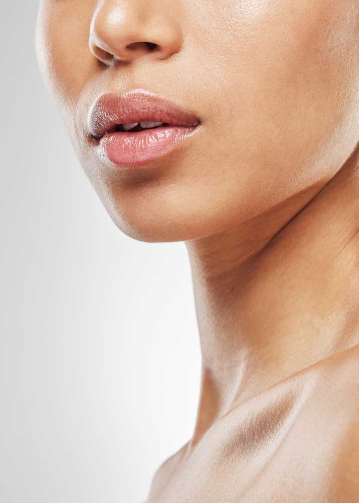 radiesse treatments
