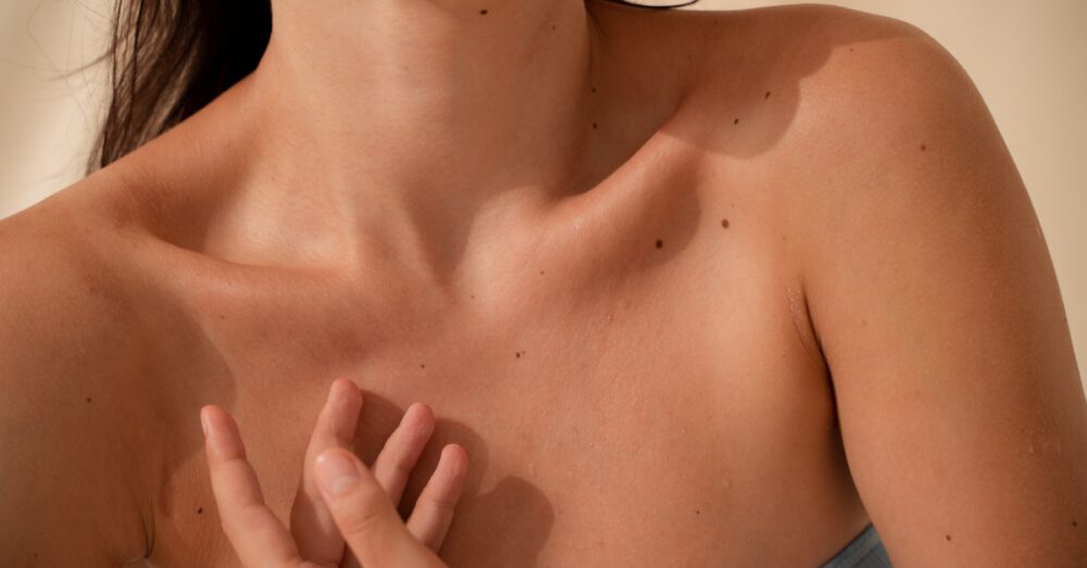A close up of a woman’s collarbones, showcasing clear skin after treatment